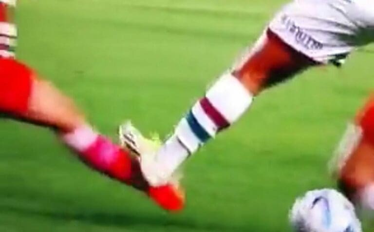 El brasileño Marcelo le fracturó la pierna a Luciano Sánchez, jugador de Argentinos Juniors en la Copa Libertadores.