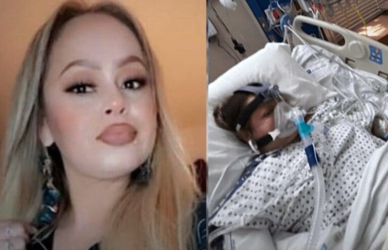 Amputan brazos y piernas a mujer por comer un filete de pescado