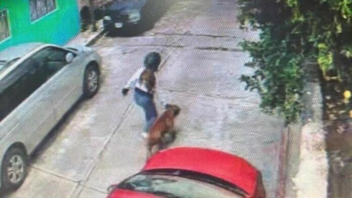 En estado 'crítico' permanece niño atacado por pitbull en Morelos; exigen al dueño del animal que se haga responsable