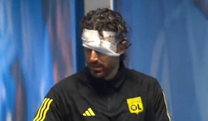 La violencia se hizo presente en el futbol francés. Seguidores del Marsella apedrearon el autobús del Lyon. Hubo lesionados.