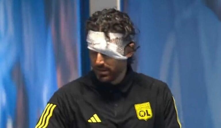 La violencia se hizo presente en el futbol francés. Seguidores del Marsella apedrearon el autobús del Lyon. Hubo lesionados.