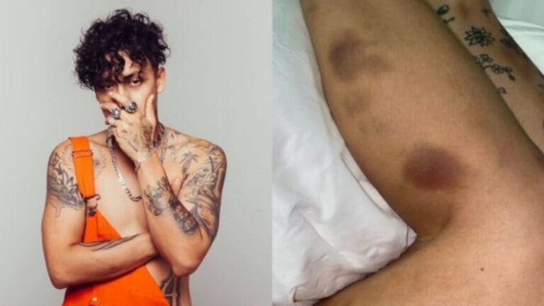 Akasha, novia del rapero Alemán, comparte fotos de golpes y audio de pelea