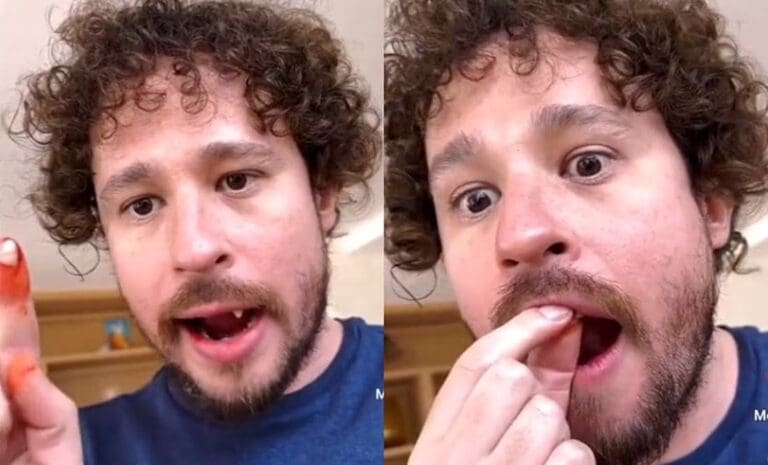 Luisito Comunica "se quita" dos dientes en vivo y preocupa a fans