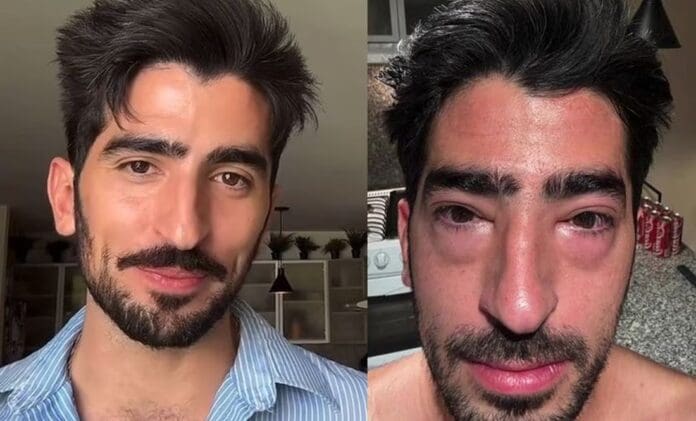 Influencer Jezzini preocupa a fans tras aparecer con los ojos hinchados; ¿qué le pasó?