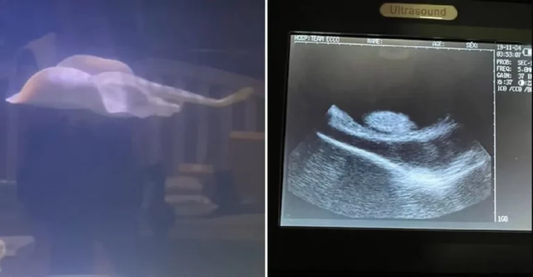 Misterio para la biología: Mantarraya estaría embarazada de un tiburón