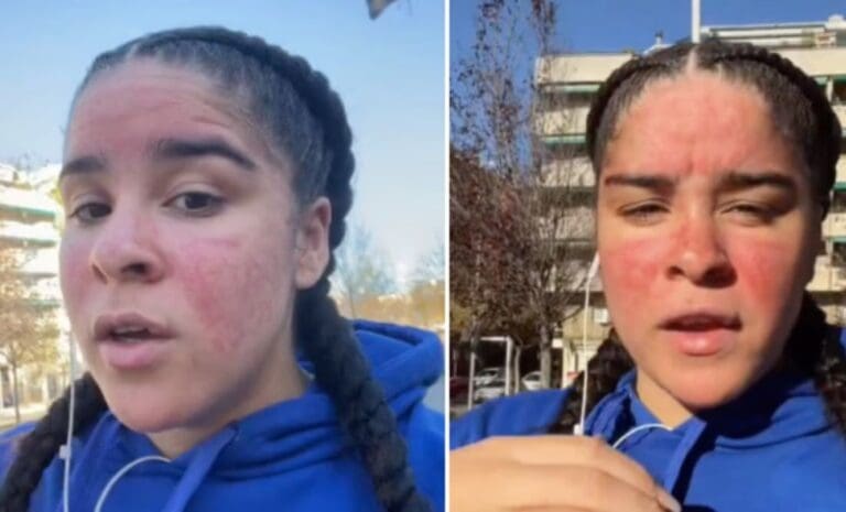 Video: Maestra de natación se hace viral tras contar que es alérgica al agua y al sudor