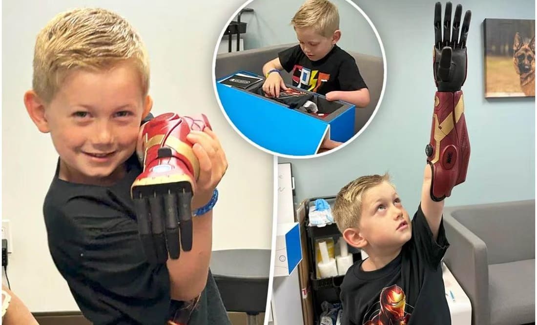 Niño de cinco años se convierte en la persona más joven del mundo en utilizar un brazo biónico