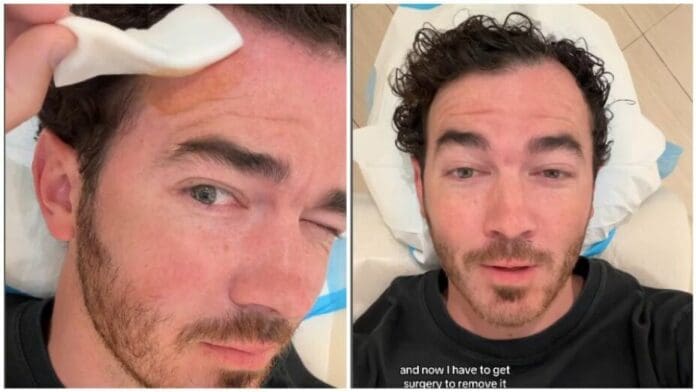 Kevin Jonas, de los Jonas Brothers, revela su lucha contra el cáncer de piel