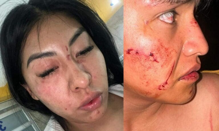 Sujeto ebrio y su familia golpean a un matrimonio y a una niña de 3 años en Puebla
