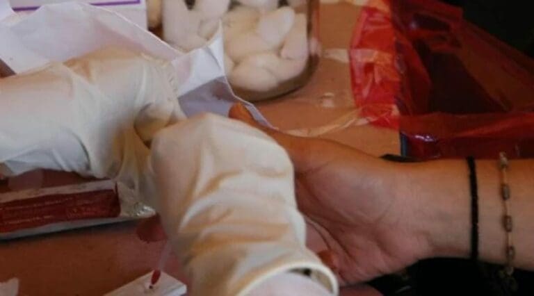 Prueban medicamentos para VIH y Sida contra los tumores cerebrales por primera vez. El estudio se realiza en el Reino Unido.