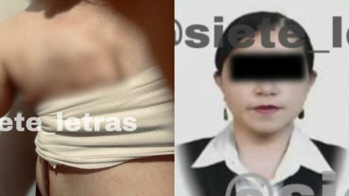 Negligencia médica: Doctora inyecta formol en lugar de anestesia y paciente pierde seno