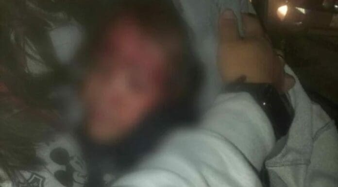 Un policía municipal de Puebla hirió a una niña de cuatro años, luego de que hizo un disparo al suelo y rebotó.