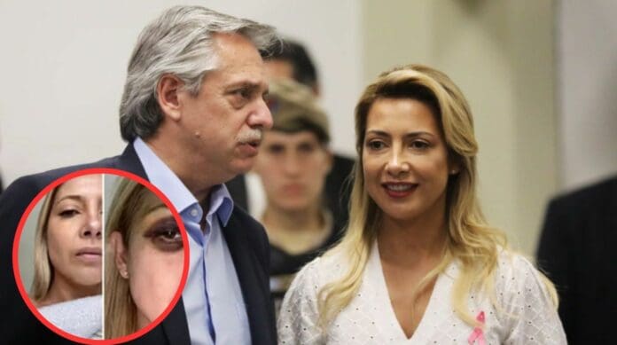 Denuncia exesposa a Alberto Fernández, expresidente de Argentina, por presunta violencia intrafamiliar