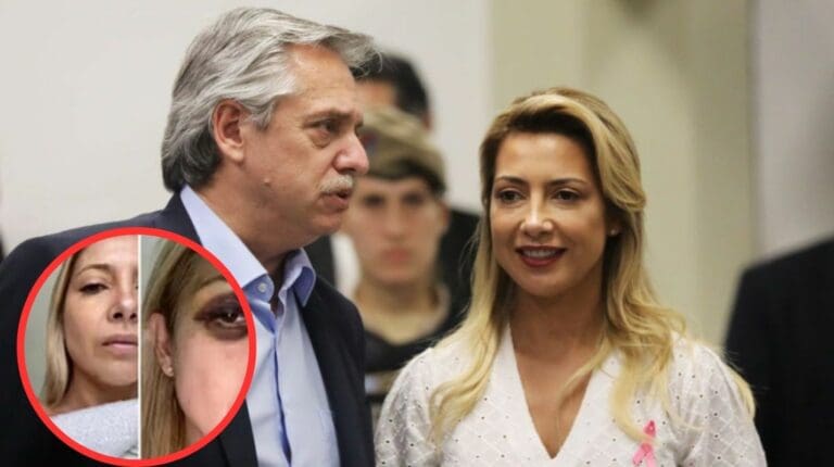 Denuncia exesposa a Alberto Fernández, expresidente de Argentina, por presunta violencia física