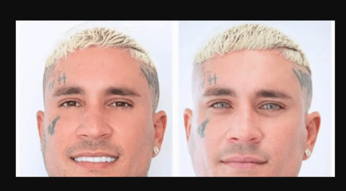 Osmani García desata polémica tras someterse a riesgoso procedimiento para cambiar el color de sus ojos