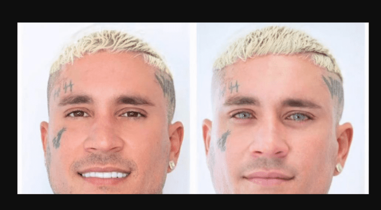 Osmani García desata polémica tras someterse a riesgoso procedimiento para cambiar el color de sus ojos