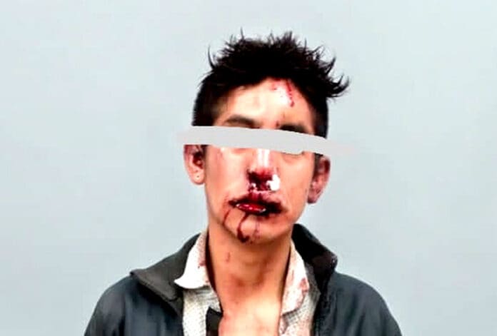 Mató a bebé, la “enmaletó”; vecinos casi lo linchan, pero huyó de hospital en la Cdmx