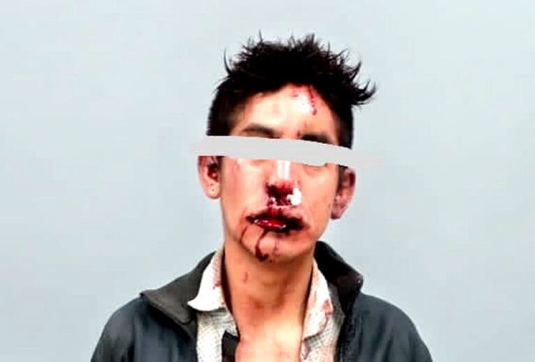 Mató a bebé, la “enmaletó”; vecinos casi lo linchan, pero huyó de hospital en la Cdmx