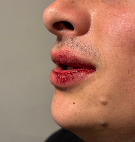 Hombre golpea a ciclistas por circular sobre la banqueta en CDMX