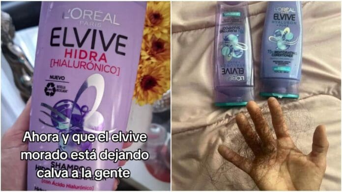 ¿Elvive morado provoca caída del cabello?