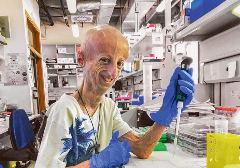 Muere Sammy Basso, la persona con envejecimiento prematuro más longeva del mundo