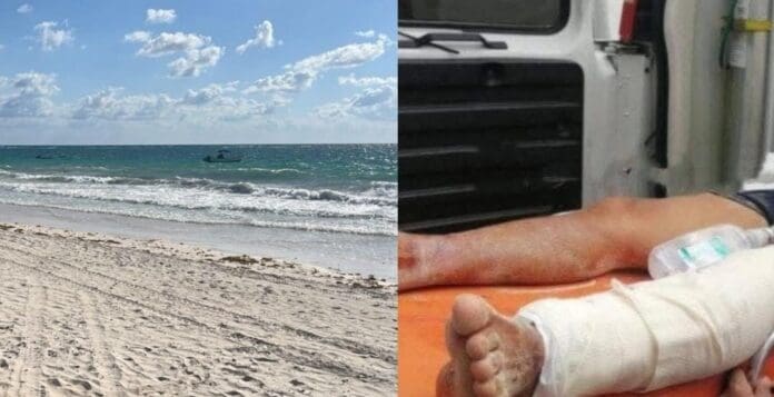 Pescador fue atacado por un tiburón en una playa de Tulum. El hombre fue lesionado en la pierna izquierda.
