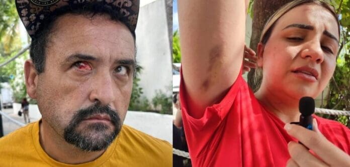 Separan de su cargo a policías de Cancún implicados en agresión en el hotel Riu, lo confirmó Ana Paty Peralta.