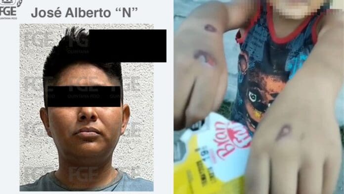 Detienen a padrastro acusado de quemar con encendedor a niño en Villas del Sol de Playa del Carmen