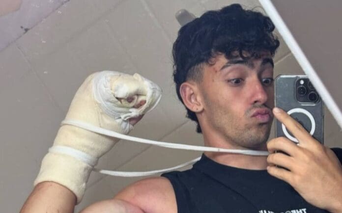 Influencer pierde dos dedos tras caer de un acantilado