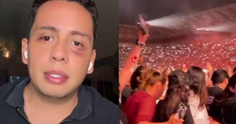 Fan de Shakira podría perder la vista tras ser secuestrado y golpeado saliendo de concierto en CDMX
