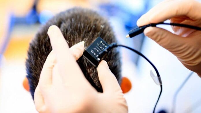 Mujer con parálisis logra hablar después de 18 años gracias a un implante cerebral con IA