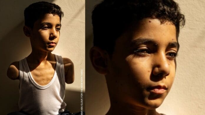 Retrato de niño palestino sin brazos es elegida como 