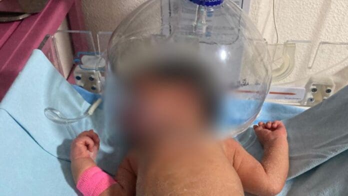 Hospital Comunitario de Tabasco utiliza botella de plástico para atender a un recién nacido