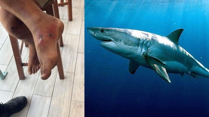 Descartan ataque de tiburón en Playa del Carmen; extranjero presentaba lesión previa por mordedura de algún tipo de fauna no identificada