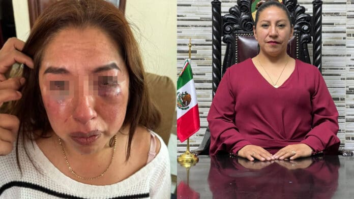 Psicóloga del DIF acusa a la alcaldesa de Capulhuac, Edomex, de agredirla física y sexualmente
