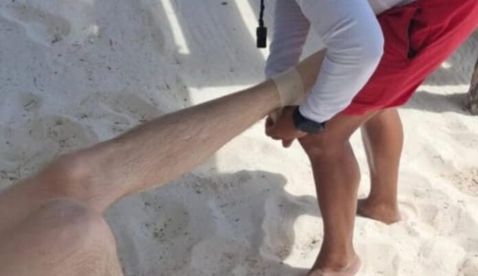 Bañistas terminan lesionados por la presencia de rayas y mantarrayas en playas de Cancún. Piden tener cuidado.