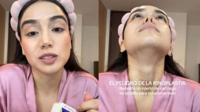 Video: Influencer se hace rinoplastia y ahora tiene problemas para respirar