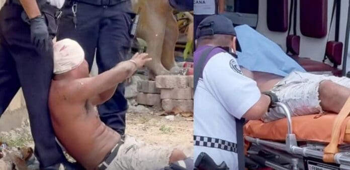 Un sujeto ataca a su expareja y a su excuñada en Cancún; se dijo que una de ellas perdió un dedo tras ser mordida.