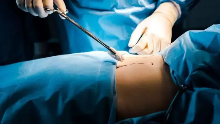 Muere mujer tras someterse a una cirugía estética en Chihuahua