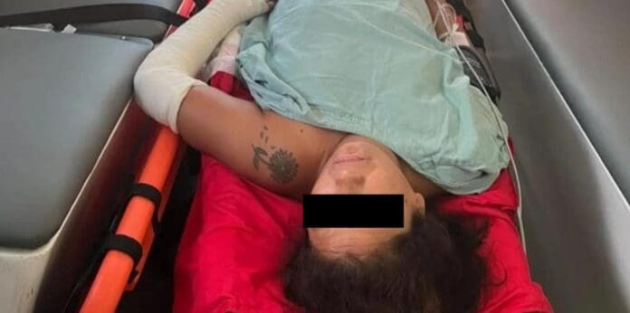 Trasladarán a una mujer de Argentina que cayó de tercer piso en Tulum; se fracturó columna y ambas piernas.