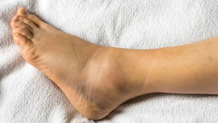 Mujer recibe 11 mdd tras demandar a una tienda donde se torció el tobillo en Estados Unidos