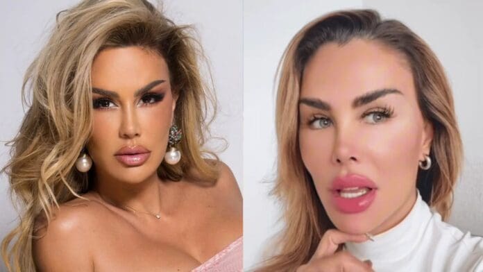 Ninel Conde se somete a cirugía para cambiar el color de sus ojos