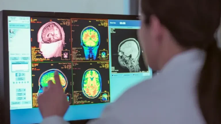 Científicos de la Universidad de Cambridge, Inglaterra, revelan que el cerebro humano se hace adulto a los 32 años