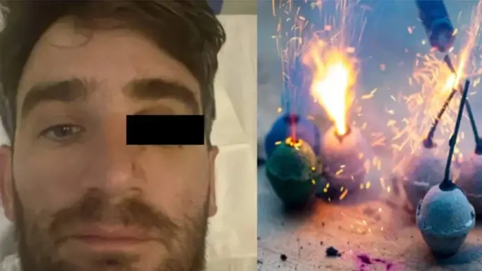 Hombre pierde un ojo tras explosión de pirotecnia en Buenos Aires, Argentina