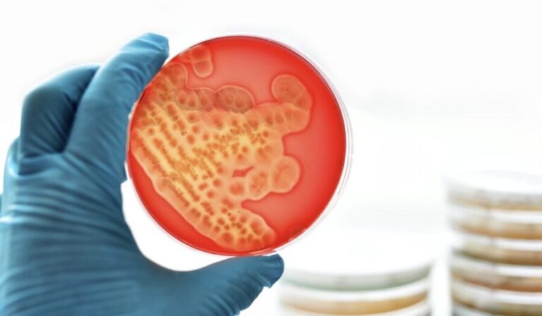 UNAM crea sistema para identificar superbacterias resistentes a antibióticos 