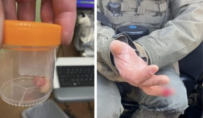 De una mordida, manifestante arranca dedo de agente federal en Minneapolis, Estados Unidos