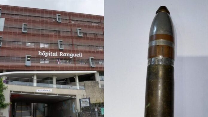 Hombre es ingresado de urgencia a hospital de Francia tras introducirse un proyectil de 16 centímetros por el recto