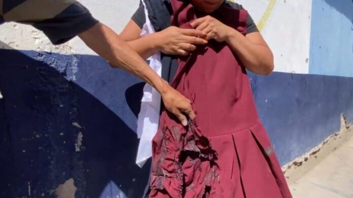 Alumna sufre quemaduras tras realizar experimento sin la supervisión del profesor en Tehuacán, Puebla